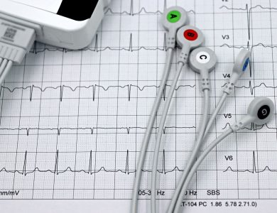Close-up of ECG monitor leads on a printed cardiogram, showcasing heart health diagnostics.