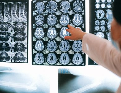 Radiologist pointing at brain MRI scans showing detailed medical examination.